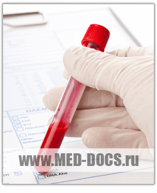 Результат общего анализа крови (клинического)